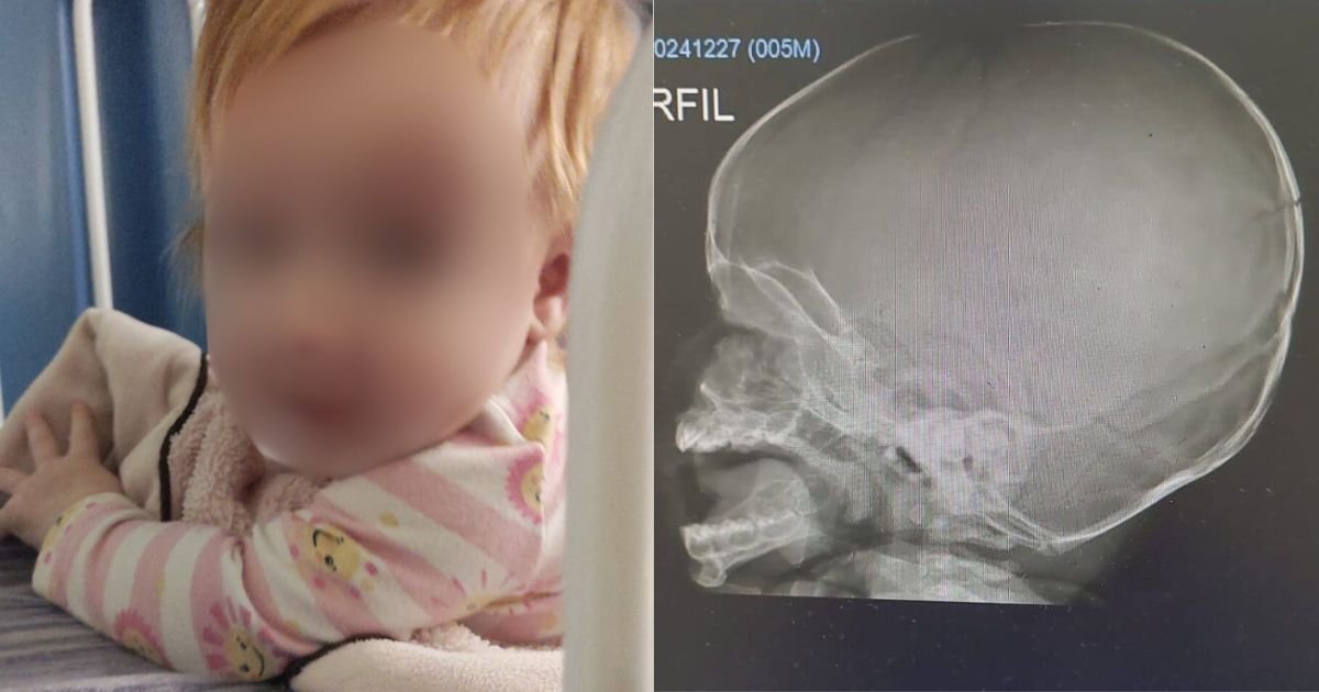 MP cobra imagens de queda de bebê em creche de SC