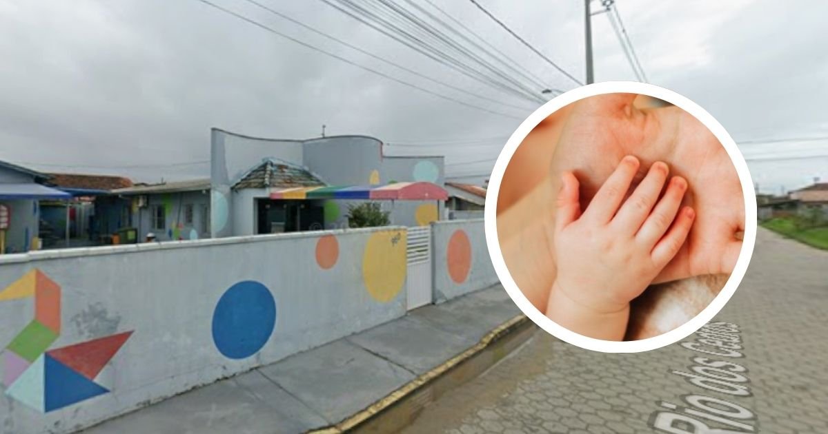 Após queimadura em creche de SC, bebê de 1 ano faz exames