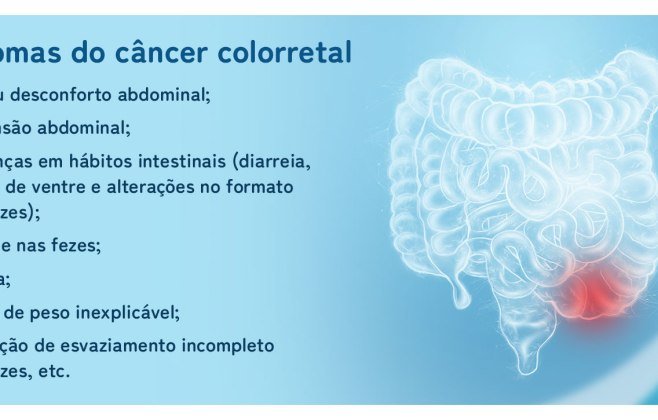 Sinais do câncer colorretal devem ser checados com rapidez; saiba mais