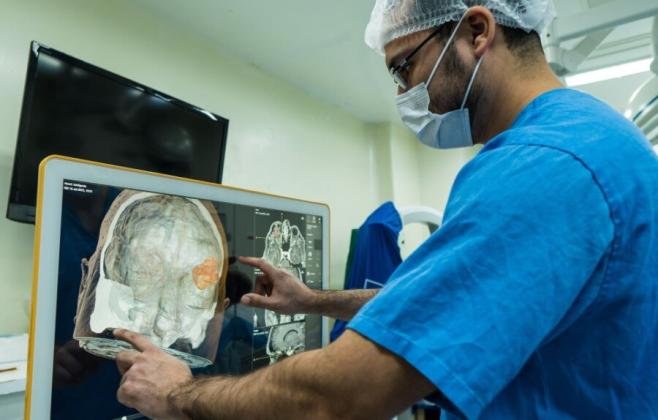 Alesc: Semana de prevenção ao AVC traz orientações sobre fatores de risco e sintomas da doença