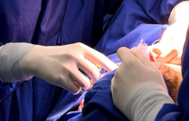 Orelhas de abano: Hospital Infantil Joana de Gusmão promove ação de cirurgias para correção de orelhas proeminentes